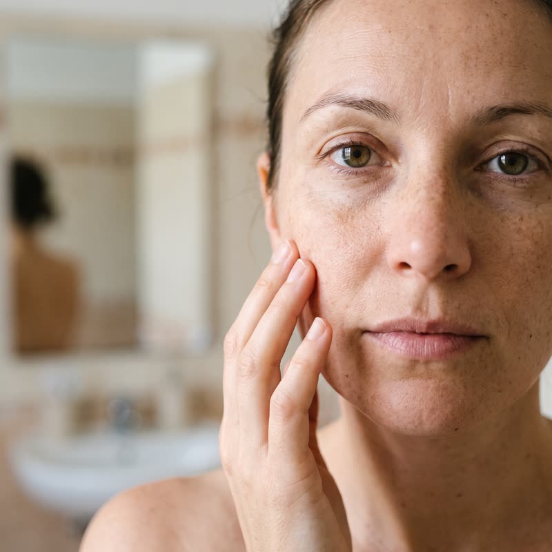 Taches et hyperpigmentation sur le visage